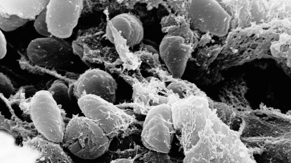 Everything You Need to Know About the Bubonic Plague Cases in China